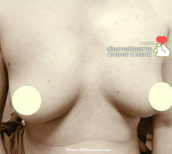 ตัดหน้าอก 40000-50000 บาท (ไม่รวมตัดแต่งหัวนม) ตัดแต่งหัวนม 10,000 บาท